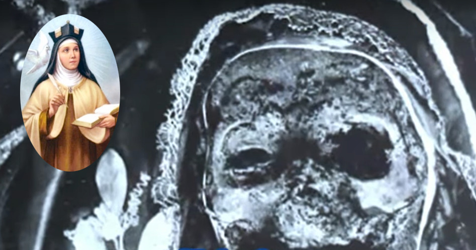 Jenazah Santa Teresa yang Wafat 450 Tahun Lalu Tidak Membusuk, Dianggap Mukjizat&nbsp;Tuhan